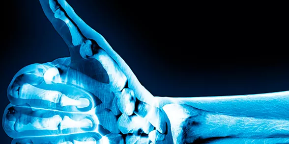 X-Ray system til røntgenstrålebeskyttelse